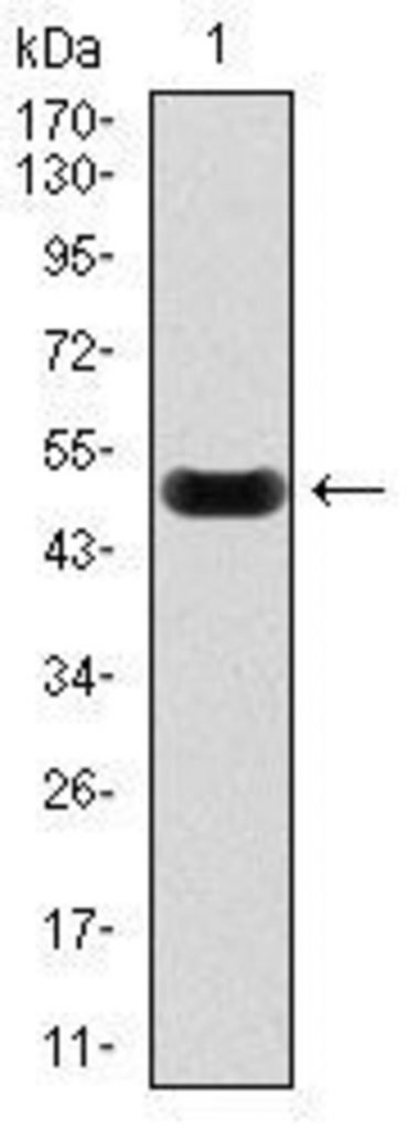 Anti C Reactive Protein CRP Antibody WB 369x1024 - Anti-C-Reactive Protein (CRP) Antibody