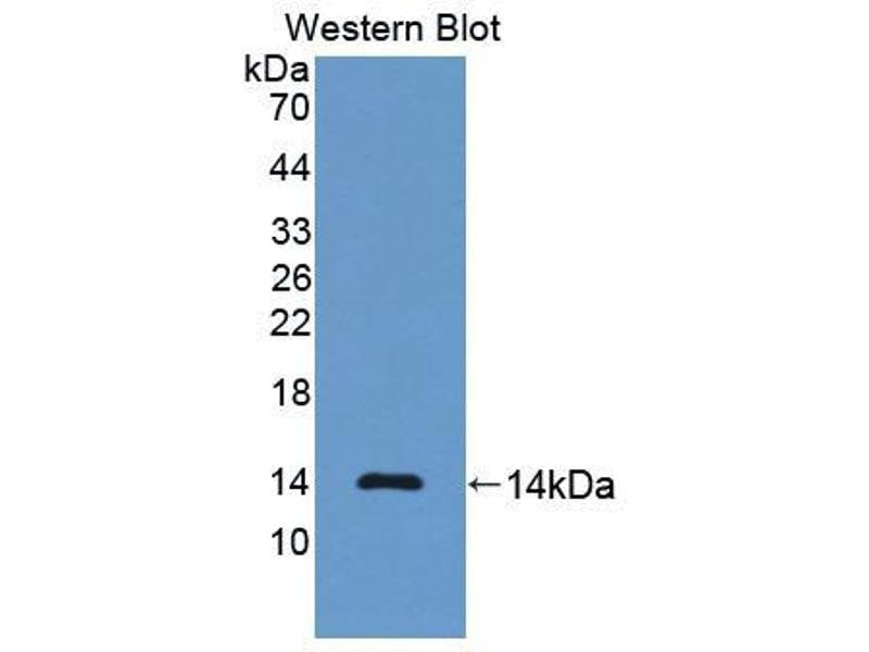 Anti NT ProBNP Antibody WB - ARCA Cap Analog CAS 400806-46-4