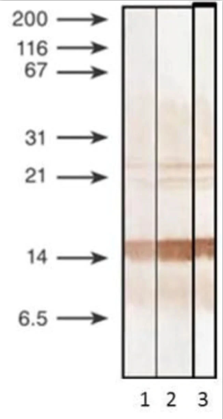 Anti PCT antibody in WB - Anti-PCT (Procalcitonin CAS 56645-65-9) antibody