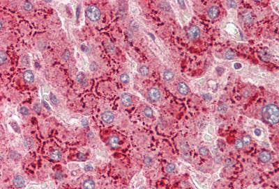 Anti-Serum-Amyloid-A-SAA-Antibody-IHC