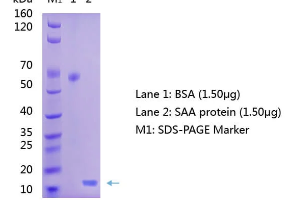 Anti-Serum-Amyloid-A-SAA-Antibody-WB Anti-Serum Amyloid A (SAA) Antibody