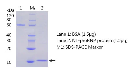 NT proBNP SDS PAGE and WB - Anti-NT-ProBNP (Pro-Brain Natriuretic Peptide CAS 124584-08-3, 114471-18-0) Antibody