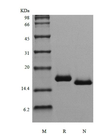 sds page 103 05 2 - Recombinant Human Fms-related Tyrosine Kinase 3 Ligand (rHuFlt-3Ligand) CAS 103-05-1816