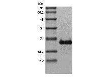 sds page 103 16R 2 - Recombinant Human Transmembrane Activator and CAML Interactor/TNFRSF13B (rHuTACI/TNFRSF13B) CAS 103-1618-1816