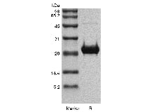 sds page 104 19 2 - Recombinant Human Fibroblast Growth Factor 19 (rHuFGF-19) CAS 104-19-1816