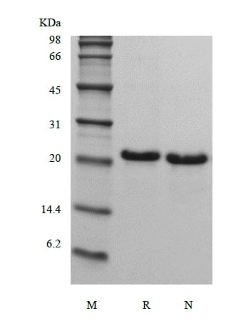 SDS-PAGE of Recombinant Human Fibroblast Growth Factor 21