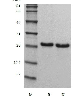 sds page 104 21 3 331x400 - Recombinant Human Fibroblast Growth Factor 21 (rHuFGF-21) CAS 104-21-1816