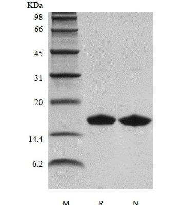 Recombinant Human Apolipoprotein-Serum Amyloid A1 (rHuApo-SAA1) CAS 602-26-1816 sds page 106 06 3 349x400 - Recombinant Human Apolipoprotein-Serum Amyloid A1 (rHuApo-SAA1) CAS 602-26-1816