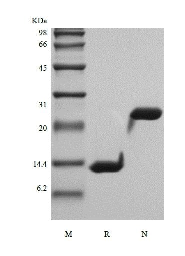 sds-page-111-05