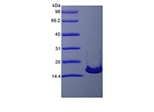 sds-page-121-21