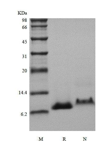 sds-page-125-01