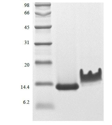sds page 145 08 3 361x400 - Recombinant Rat Heparin-binding EGF-like Growth Factor (rRtHB-EGF) CAS 145-08-1816