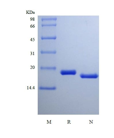 sds-page-147-16