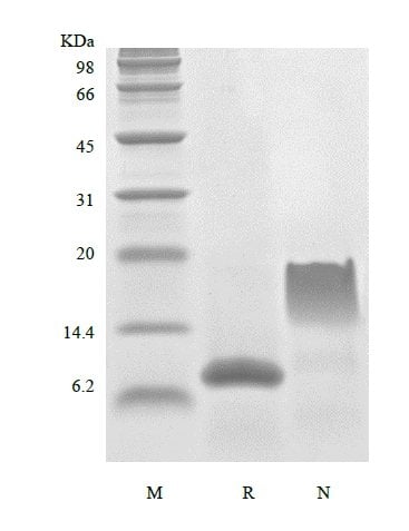 sds-page-201-12B
