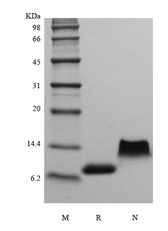 sds-page-203-01