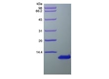 sds-page-204-01