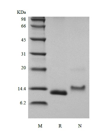 sds-page-204-02