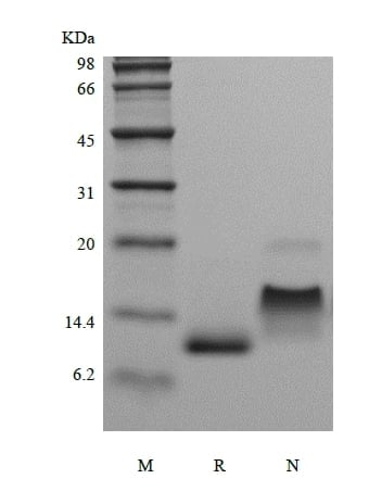 sds-page-204-11
