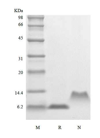 sds page 204 15T 2 - Recombinant Human Macrophage Inflammatory Protein-5, 68a.a./CCL15 (rHuMIP-5,68a.a./CCL15) CAS 204-1520-1816