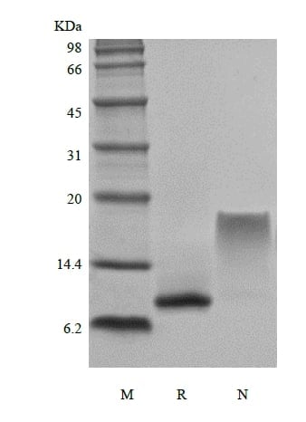 sds-page-204-23