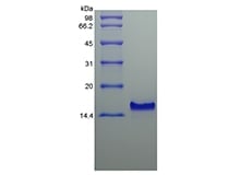 sds-page-204-25