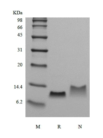 sds-page-224-04