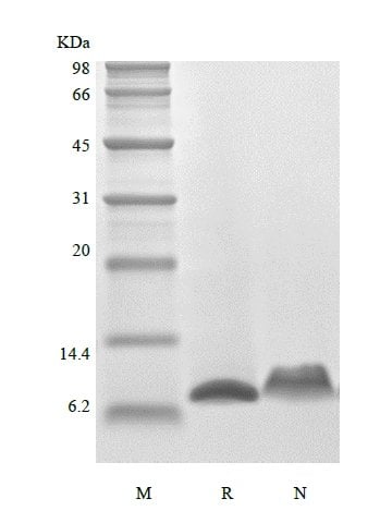 sds-page-224-05