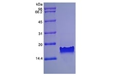 sds-page-224-25