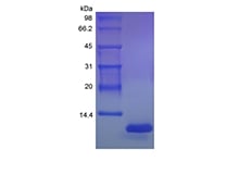 sds-page-243-01