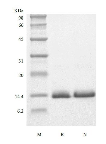 sds-page-301-07