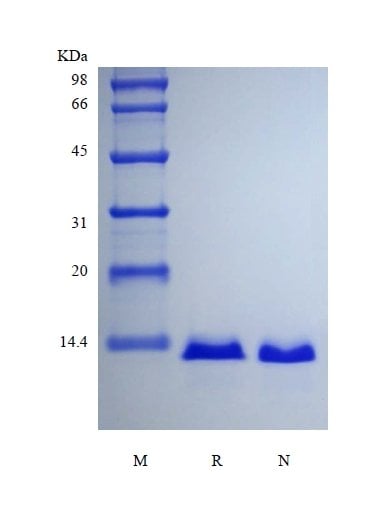 sds-page-301-07N
