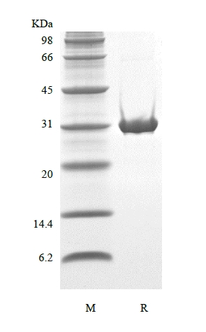 sds-page-401-13