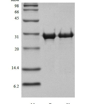 sds page 401 15 7 326x400 - Human IL-12B/p40/NKSF2 Protein, Accession: P29460
