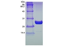 sds-page-501-01