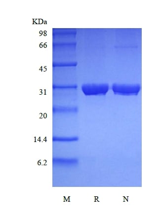 sds page 501 34A 2 - Recombinant Human Ubiquitin-conjugating Enzyme E2 R1 (rHuUBE2R1) CAS 501-341-1816