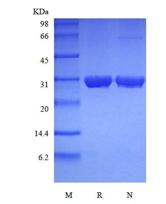 sds page 501 34A 3 326x400 - Recombinant Human Ubiquitin-conjugating Enzyme E2 R1 (rHuUBE2R1) CAS 501-341-1816