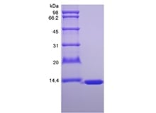sds-page-622-01