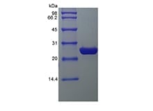 sds page 6H1 38 7 - Human IL-12B/p40/NKSF2 Protein, Accession: P29460