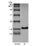 sds page GMP 101 04 7 - Human IL-12B/p40/NKSF2 Protein, Accession: P29460