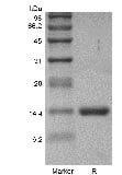 sds page GMP 102 03 7 - Human IL-12B/p40/NKSF2 Protein, Accession: P29460