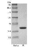 sds page GMP 103 01 7 - Human IL-12B/p40/NKSF2 Protein, Accession: P29460