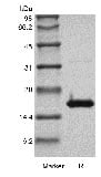 sds page GMP 106 06 7 - Recombinant Human Interferon-gamma GMP (rHuIFN-gamma) CAS 7106-06-1816