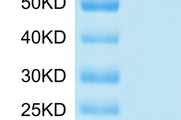 15892660219457201 600x400 - Human RETN Protein, Accession: Q9HD89