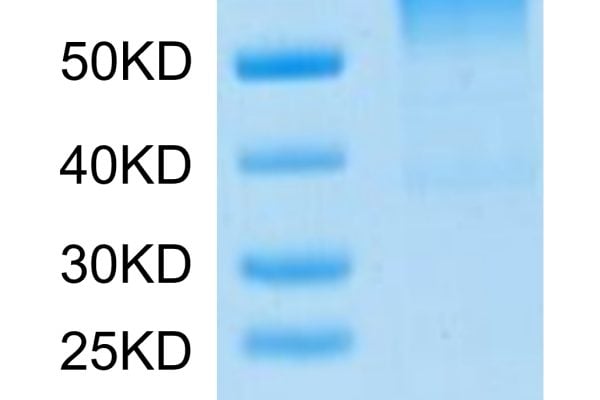 Mouse CD19 Protein, Accession: P25918