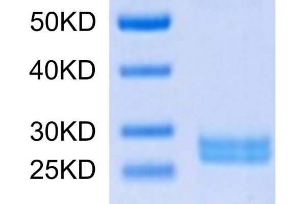 Mouse Hepcidin/HAMP Protein, Accession: Q9EQ21 20220124165500 600x400 - Mouse Hepcidin/HAMP Protein, Accession: Q9EQ21