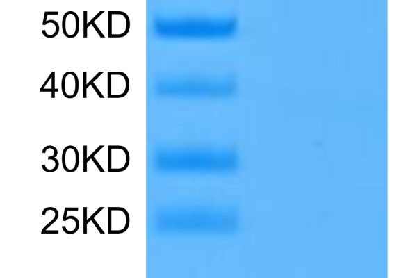 20220215113057 600x400 - Human SEZ6L2 Protein, Accession: Q6UXD5