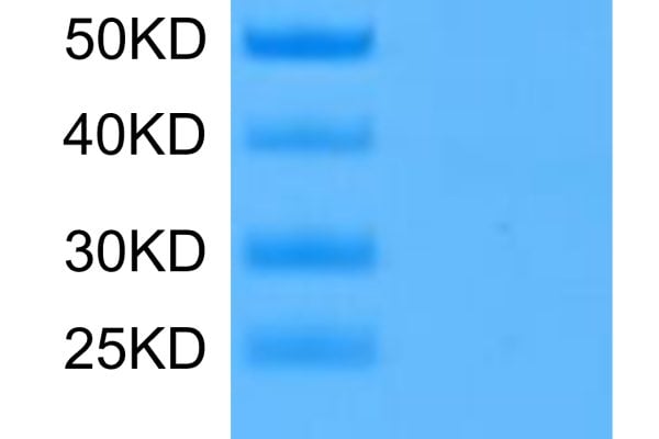 Human PADI4 Protein, Accession: Q9UM07