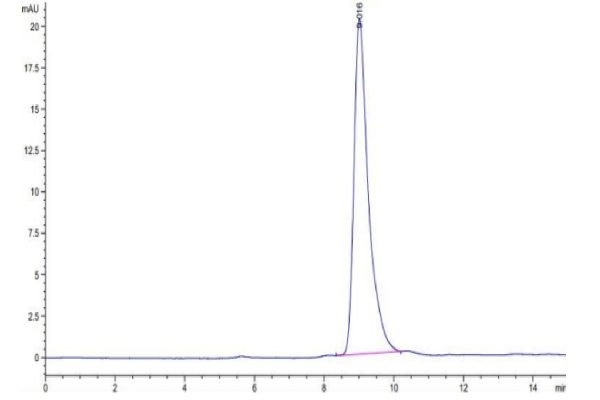 20220628102727 600x400 - Human SEZ6L2 Protein, Accession: Q6UXD5