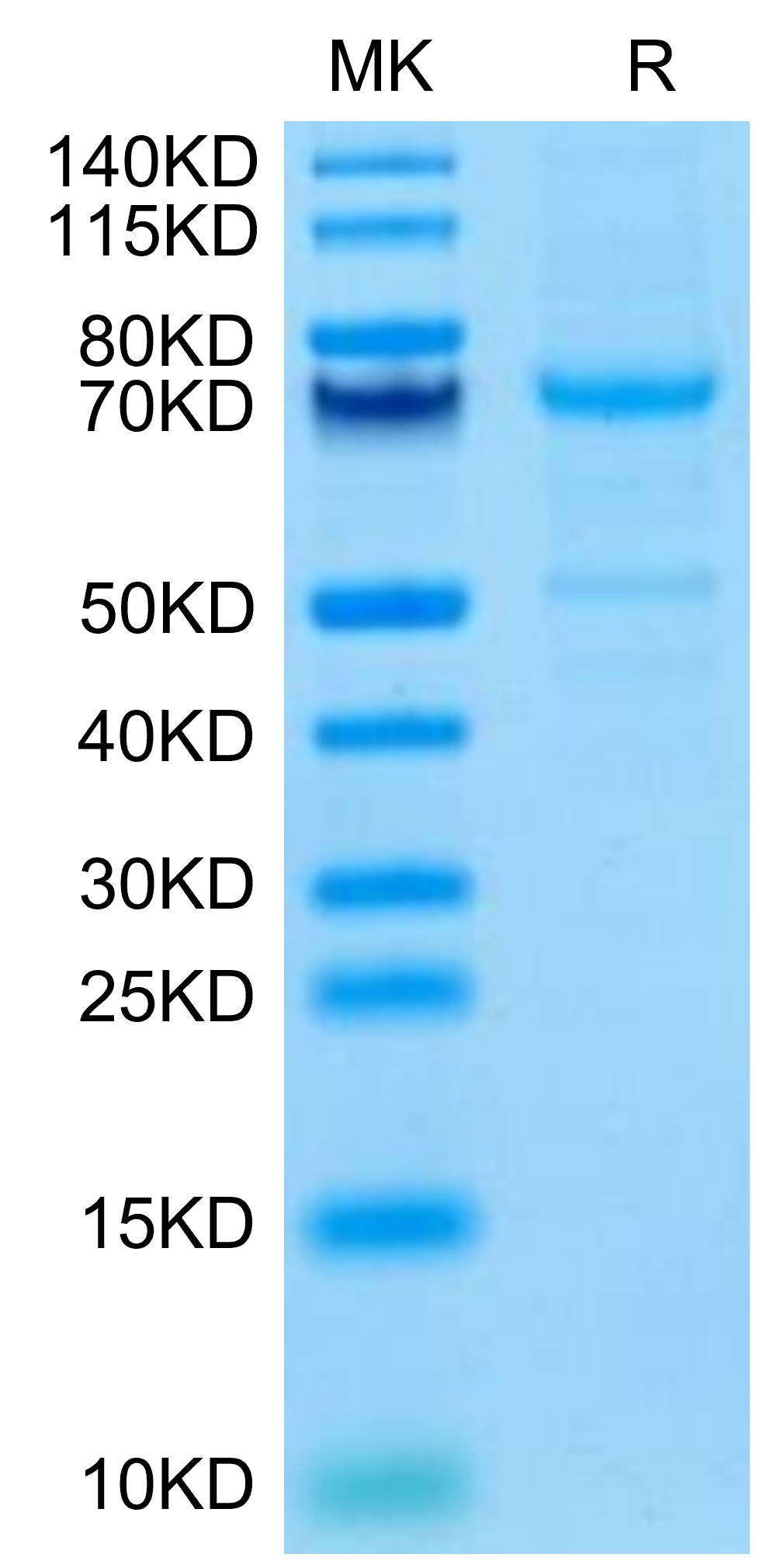 Mouse CDH3/Cadherin 3 Protein, Accession: P10287 Watson International ...