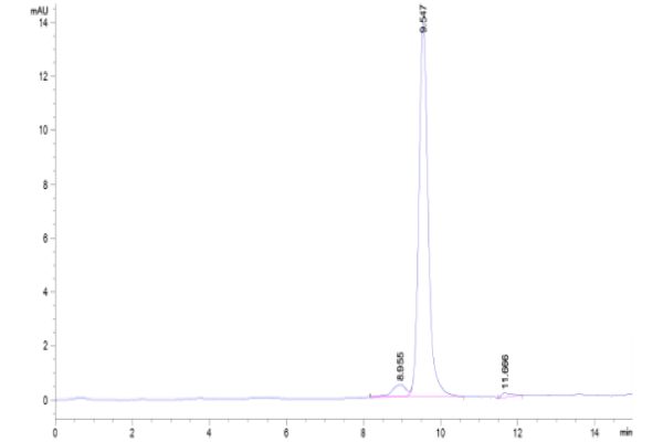 20220719132439 600x400 - Human SEZ6L2 Protein, Accession: Q6UXD5